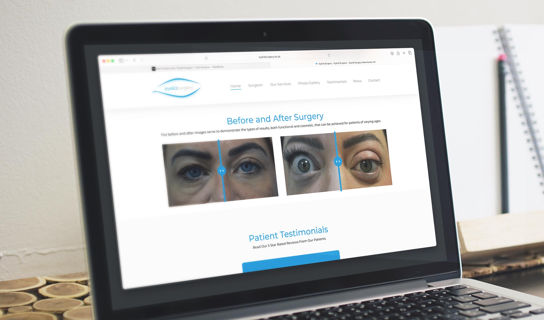 Eyelid Surgery website